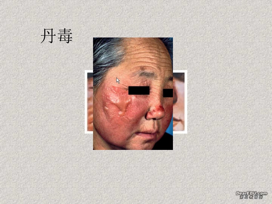 细菌和真菌在自然界中的作用八年级生物上册第五单元第五章第一节 课件_第3页