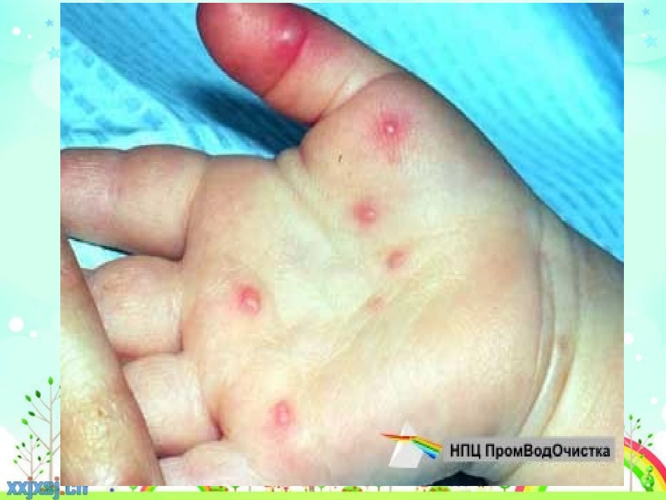 春季传染病预防_第3页