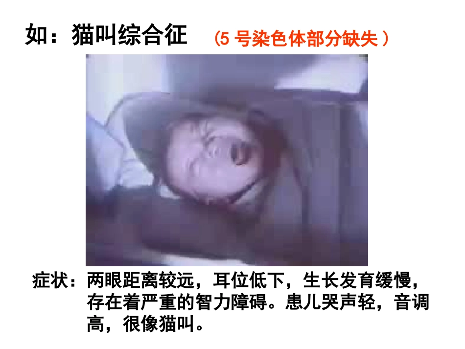 染色体变异5_第3页