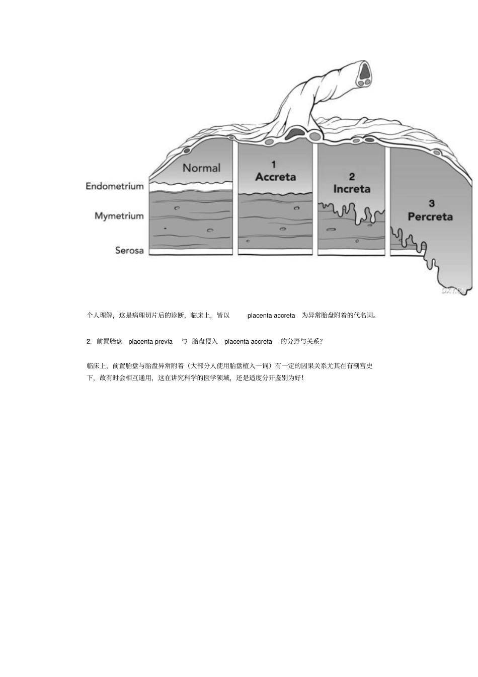 前置胎盘的麻醉汇总_第3页