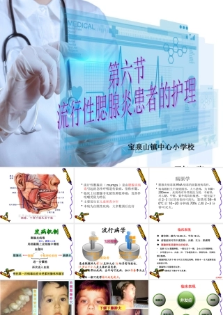 流行性腮腺炎