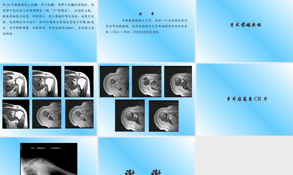 锚钉治疗肩袖损伤