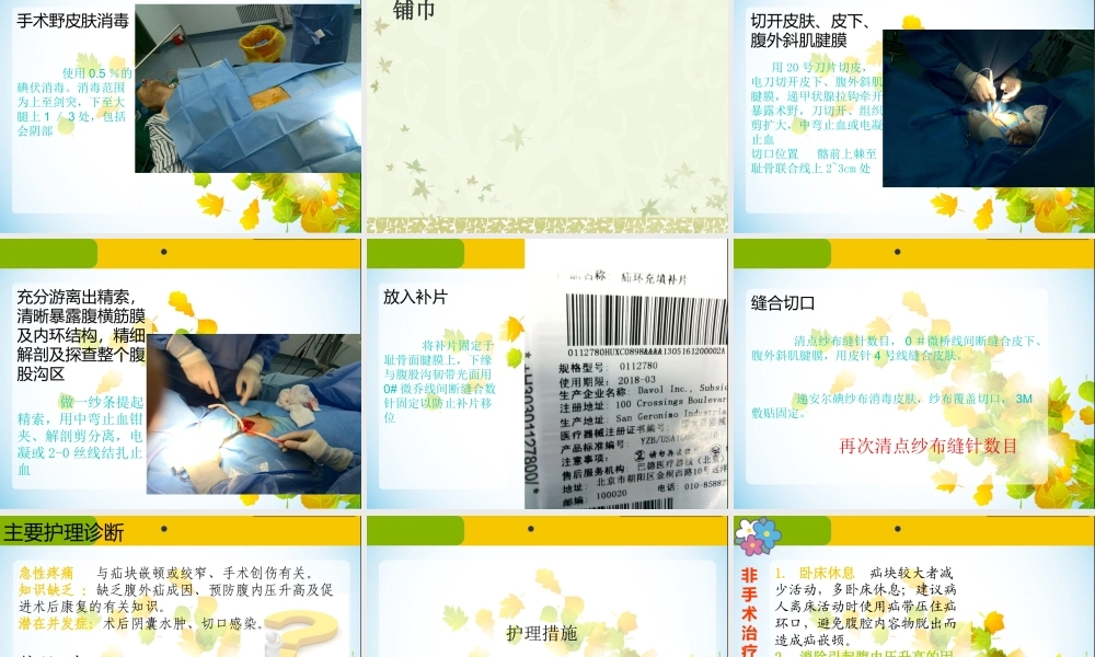 腹股沟疝手术配合ppt课件