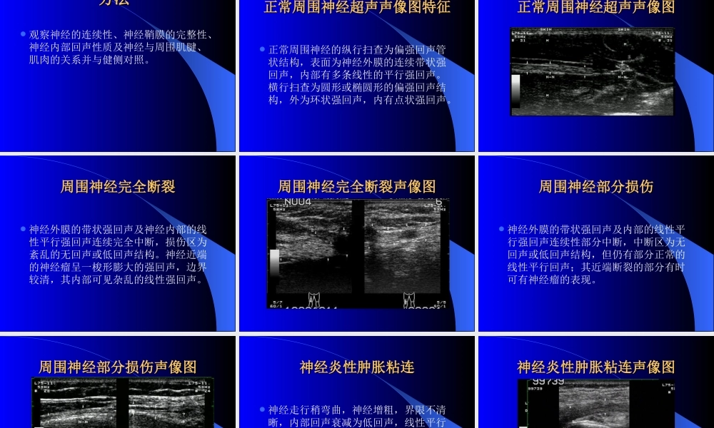周围神经损伤的超声诊断