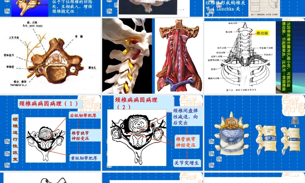 颈椎病---ppt课件