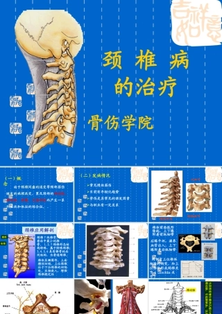 颈椎病---ppt课件