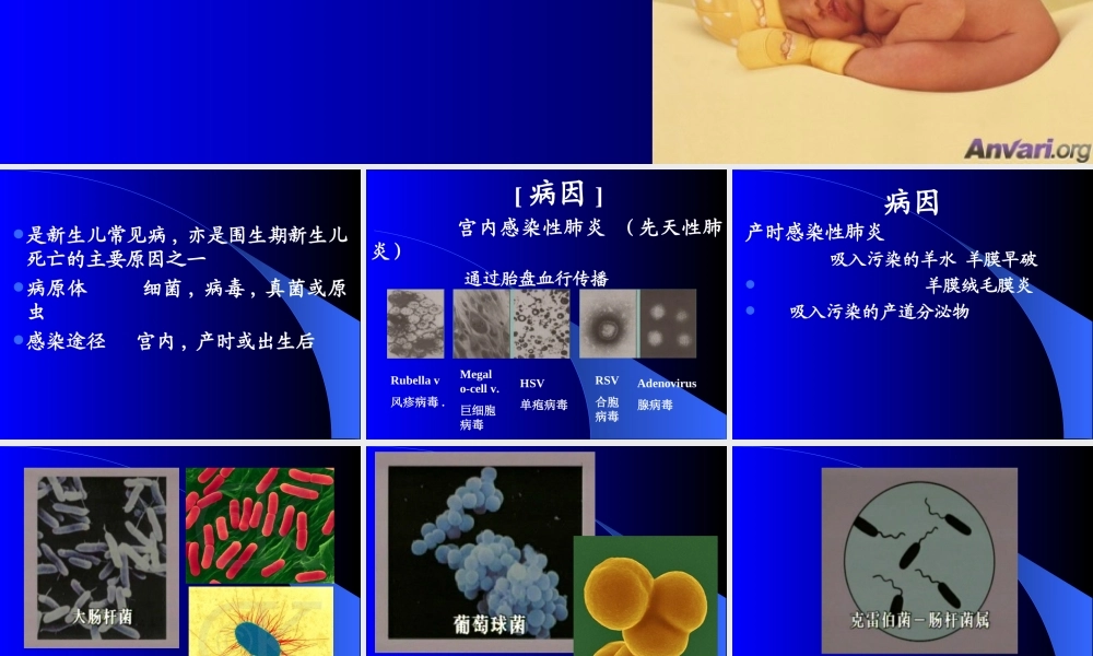 新生儿感染性肺炎讲稿