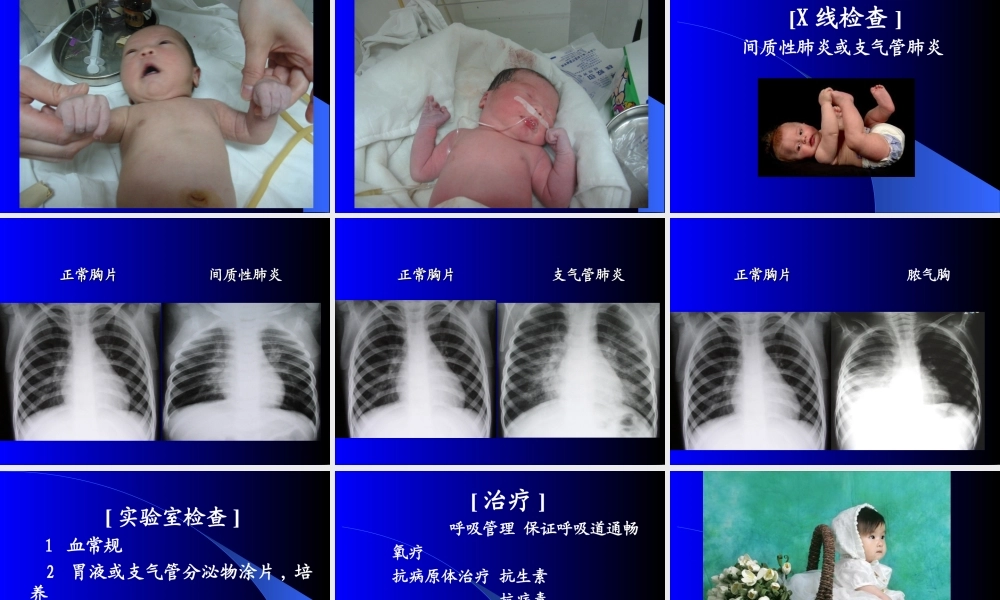 新生儿感染性肺炎讲稿