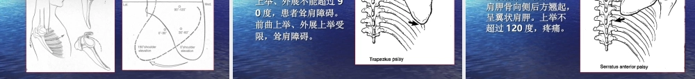 肩胛骨骨折解剖及入路