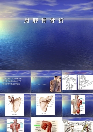 肩胛骨骨折解剖及入路
