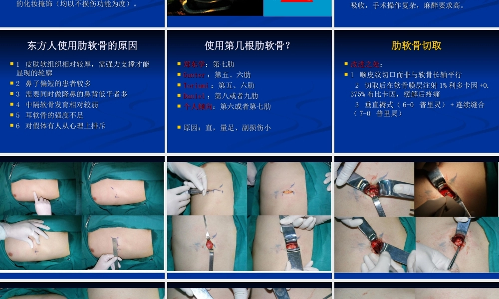 肋软骨鼻整形技术.ppt