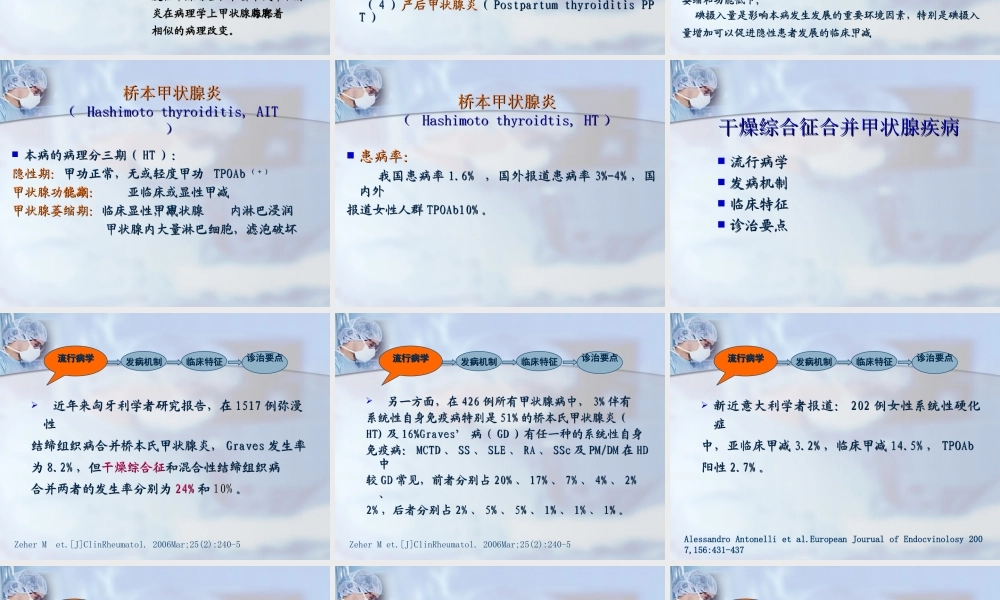 干燥综合征合并甲状腺疾