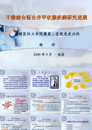 干燥综合征合并甲状腺疾