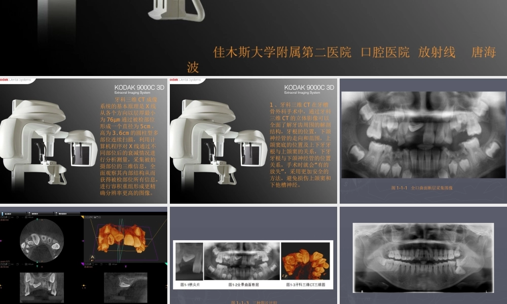 牙科三维CT临床应用