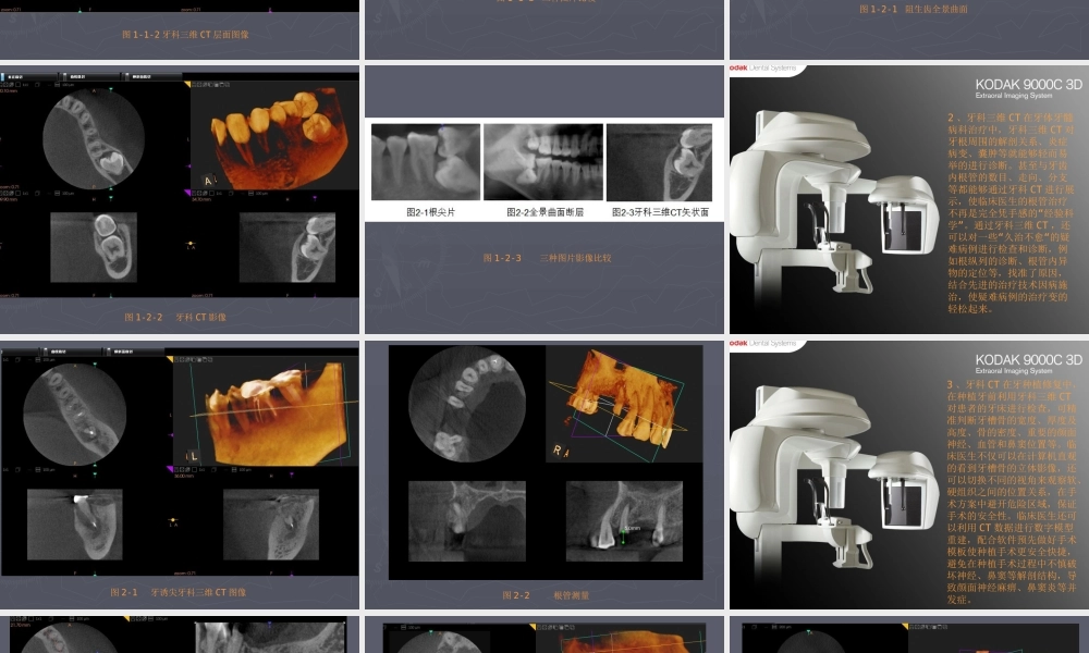牙科三维CT临床应用