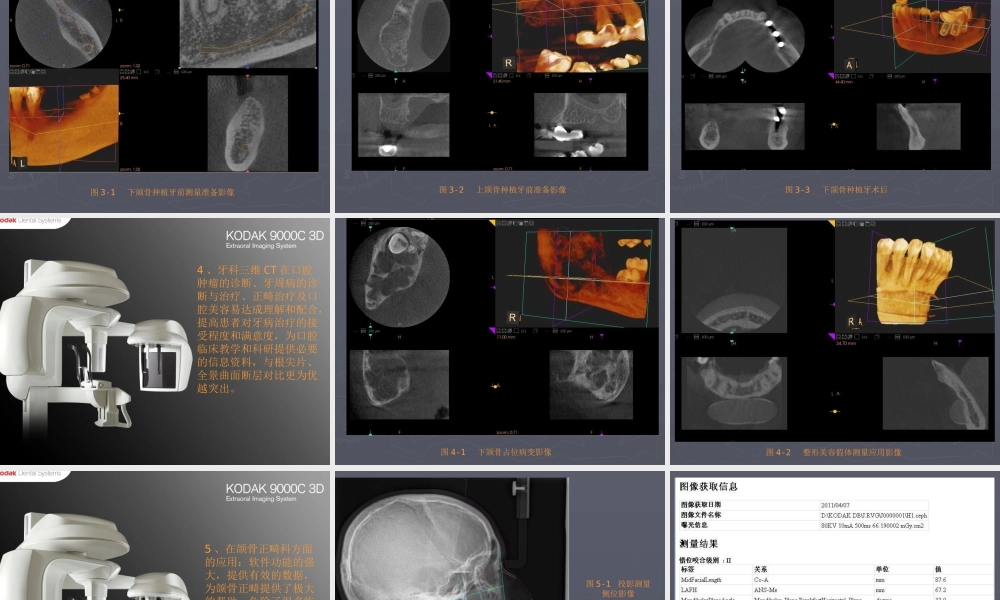 牙科三维CT临床应用
