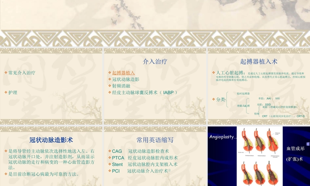 心内科介入治疗相关护理