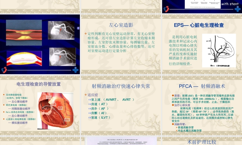 心内科介入治疗相关护理