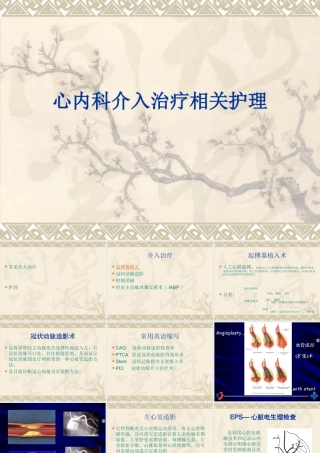 心内科介入治疗相关护理