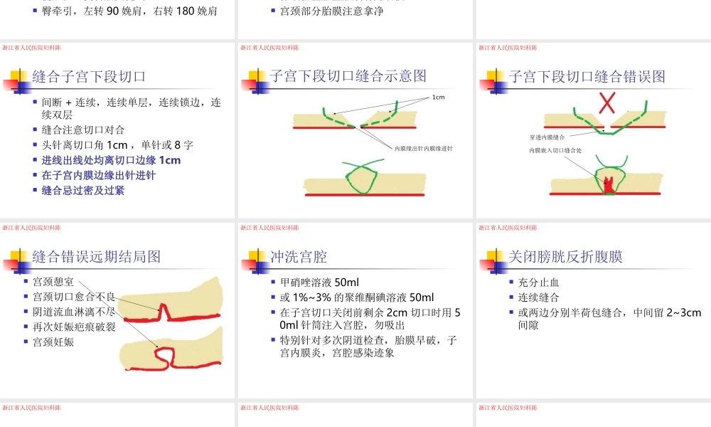 剖宫产的经验总结