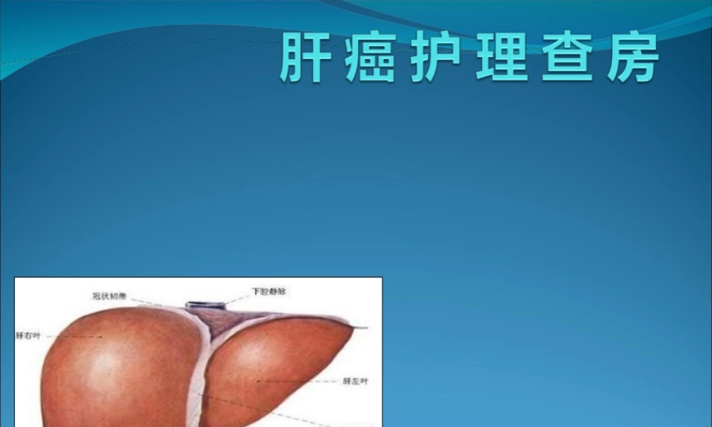 肝 癌 护 理 查 房