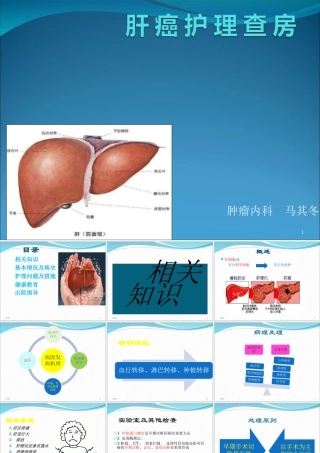 肝 癌 护 理 查 房