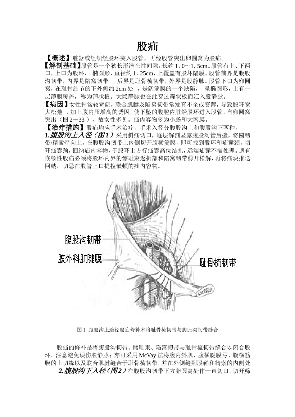 股疝知识讲解_第1页