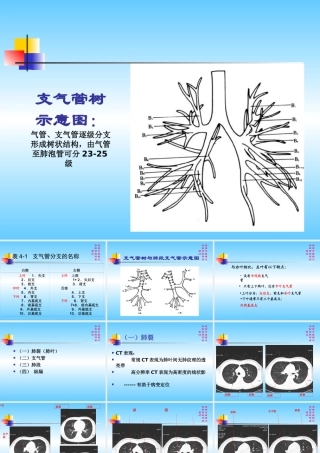 肺部CT解剖结构