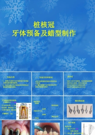 桩核冠修复后导致根折的影响因素