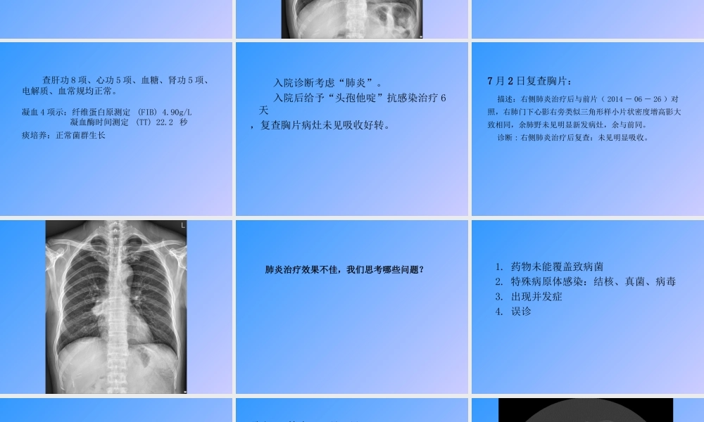 肺癌(教学查房)