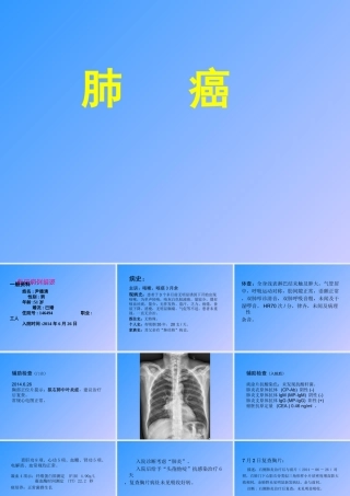 肺癌(教学查房)