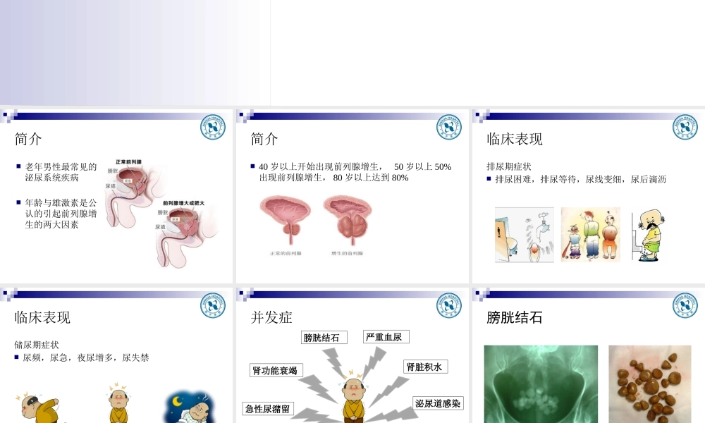 前列腺增生教学查房