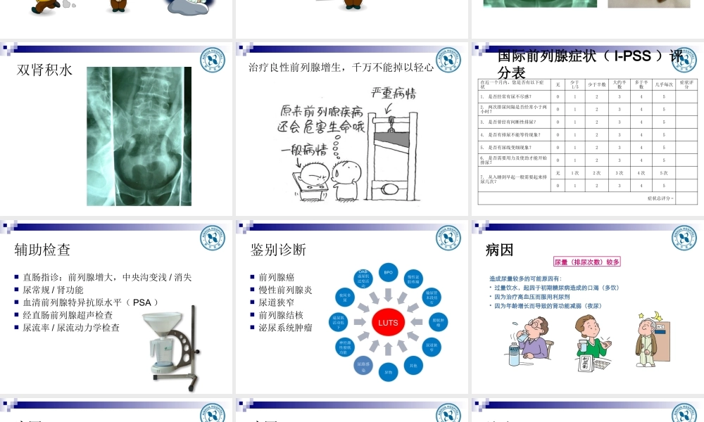 前列腺增生教学查房