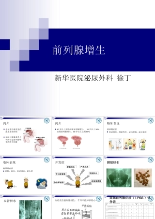 前列腺增生教学查房