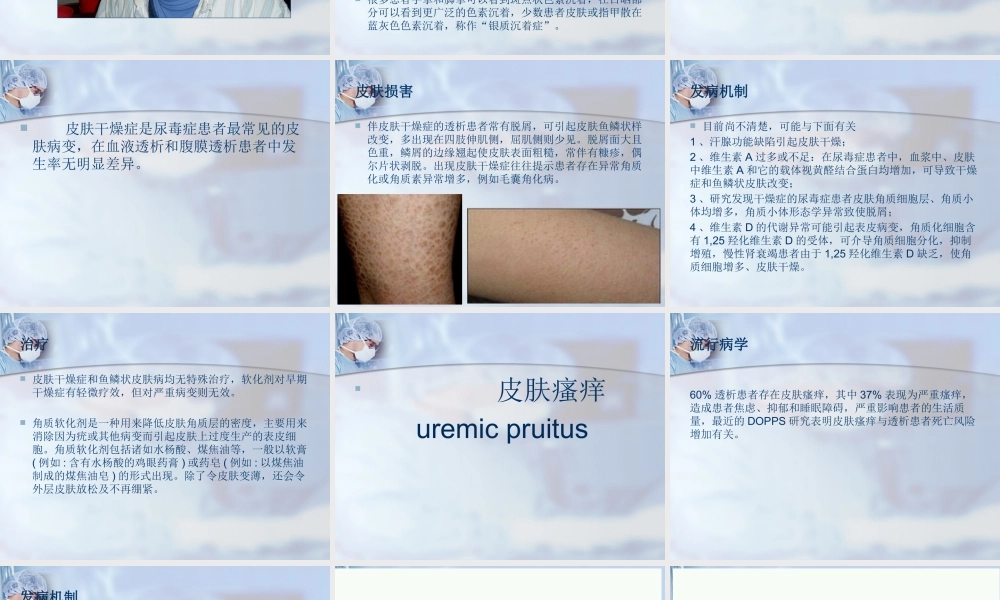 血液透析相关皮肤问题