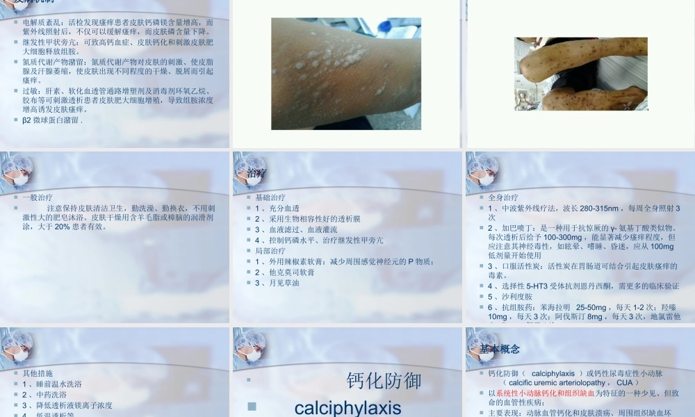 血液透析相关皮肤问题