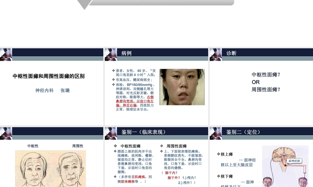 周围性面瘫和中枢性面瘫的区别