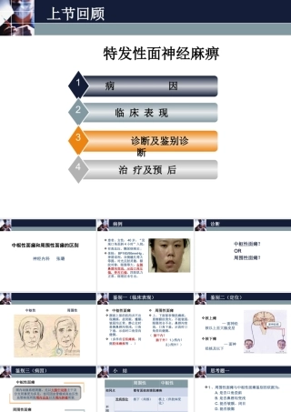 周围性面瘫和中枢性面瘫的区别