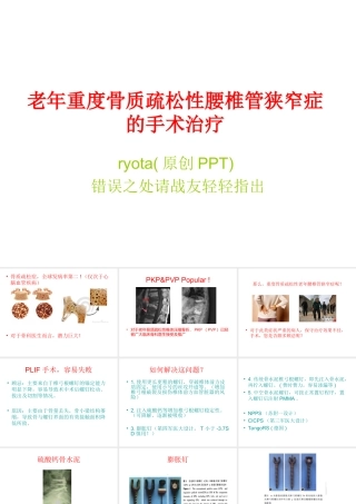 老年重度骨质疏松性腰椎管狭窄症的手术治疗