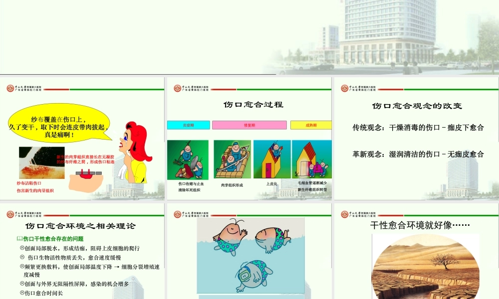 新型伤口敷料的特性与应用