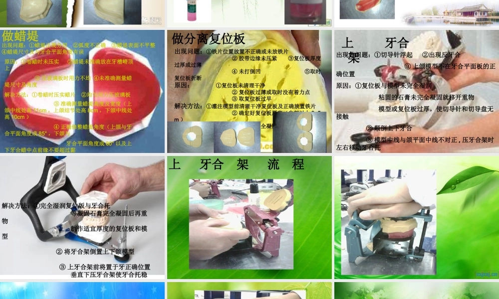全口义齿排列流程及注意事项