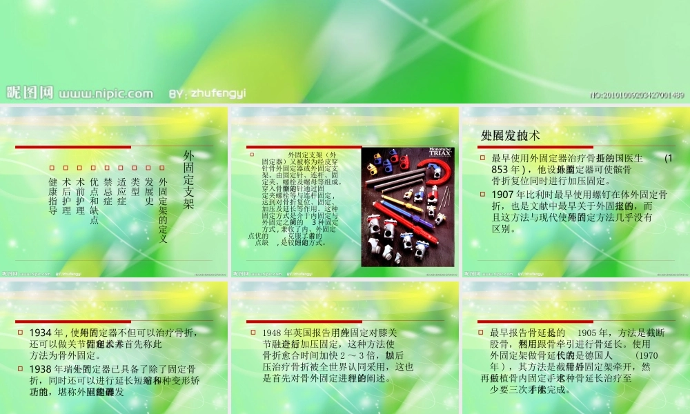 外固定支架的应用和护理