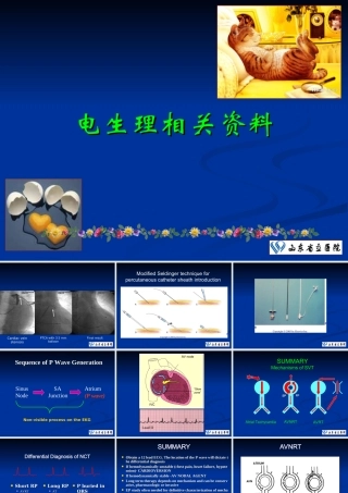 心脏电生理及射频消融基础