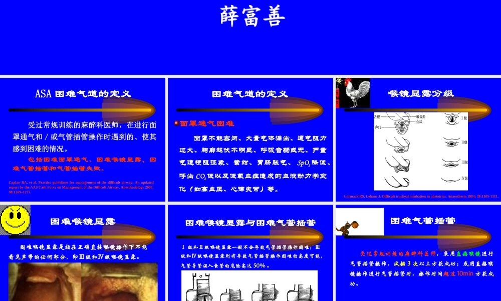 困难气道处理最新进展及指南-四川省年会-2010-11