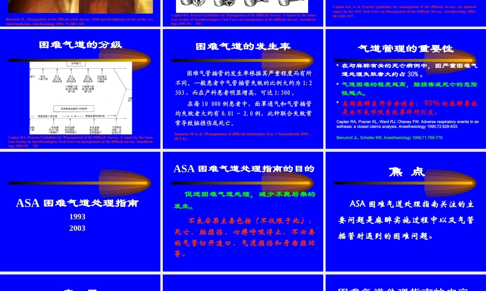 困难气道处理最新进展及指南-四川省年会-2010-11