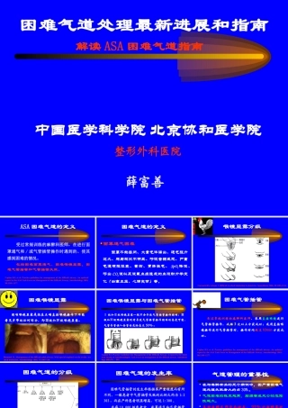 困难气道处理最新进展及指南-四川省年会-2010-11