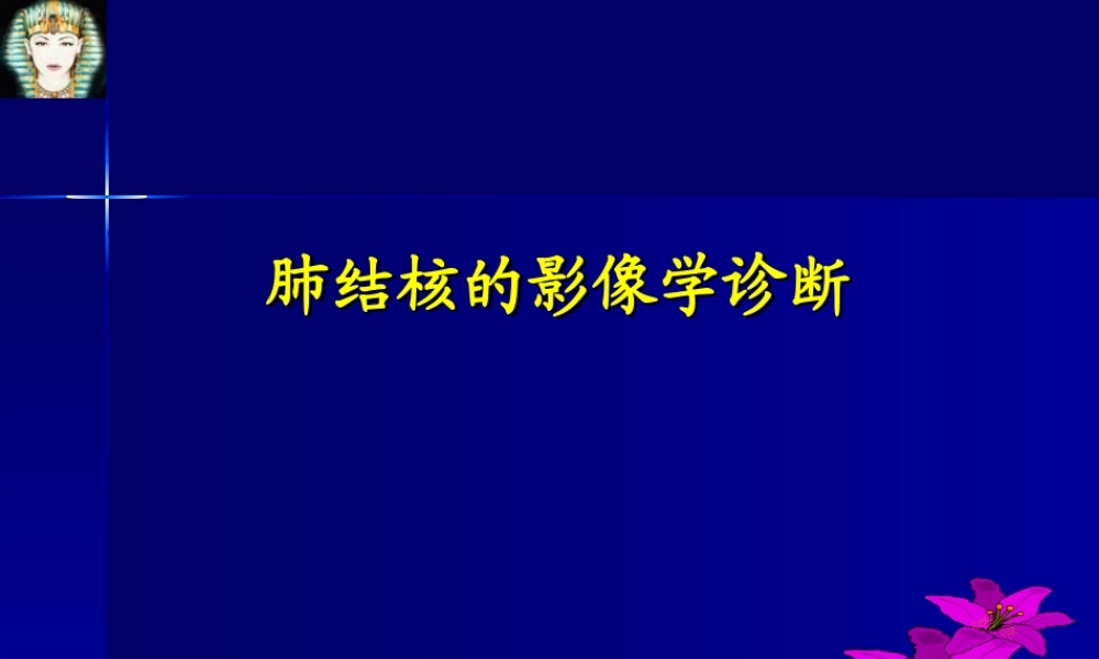 肺结核的影像学诊断