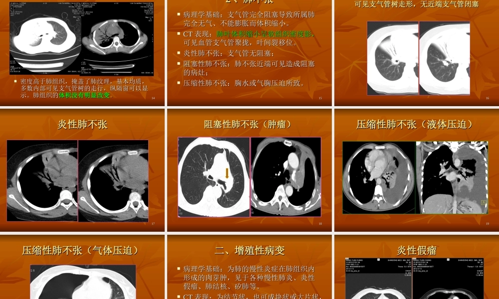 肺部基本病变CT表现课件