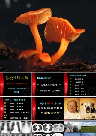 最牛的肺部CT讲座