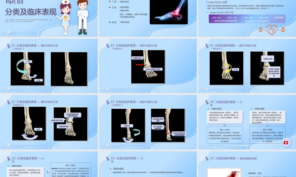踝骨骨折护理查房